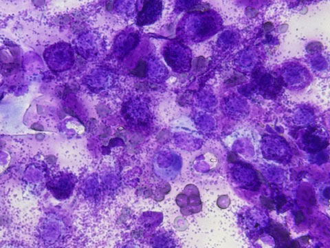 Analisi citologica al microscopio di cellule cutanee