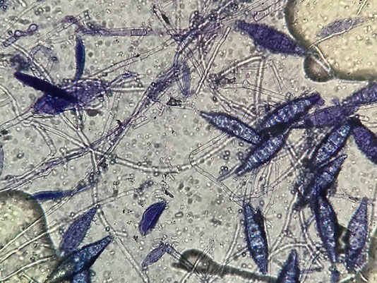 Terreni di coltura per la diagnosi dei dermatofiti